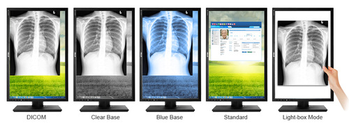 Medical Monitor (4).jpg